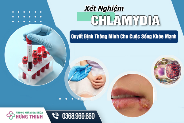 Xét Nghiệm Chlamydia - Quyết Định Thông Minh Cho Cuộc Sống Khỏe Mạnh