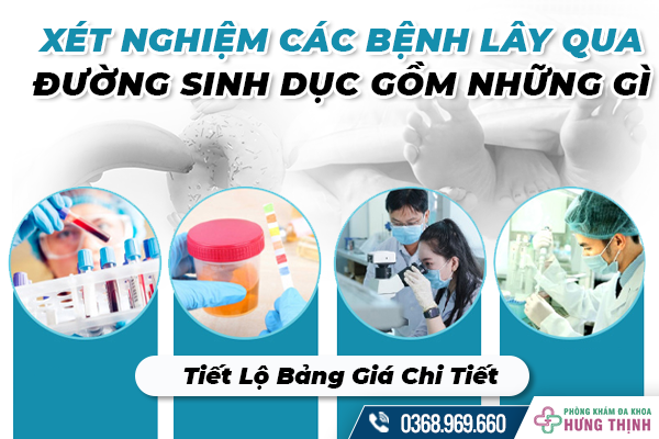 Xét Nghiệm Các Bệnh Lây Qua Đường Sinh Dục Gồm Những Gì? Tiết Lộ Bảng Giá Chi Tiết