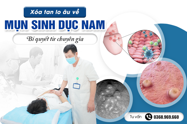  Xóa tan lo âu về mụn sinh dục nam: Bí quyết từ chuyên gia