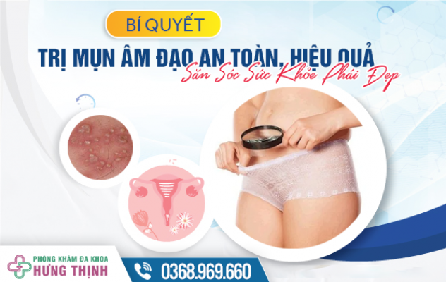 Bí Quyết Trị Mụn  Âm Đạo An Toàn, Hiệu Quả - Săn Sóc Sức Khỏe Phái Đẹp