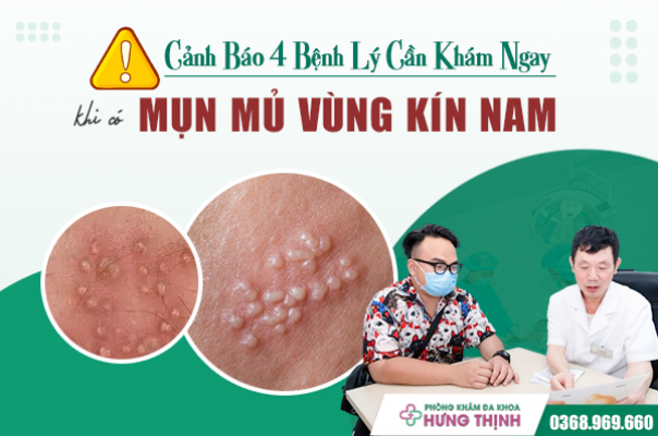 Cảnh Báo 4 Bệnh Lý Bạn Cần Đi Khám Bác Sĩ Ngay Khi Có Mụn Mủ Ở Vùng Kín Nam