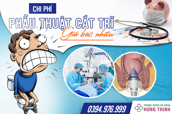 Chi phí phẫu thuật trĩ hết bao nhiêu? 