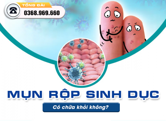 Mụn rộp sinh dục có chữa khỏi không? 