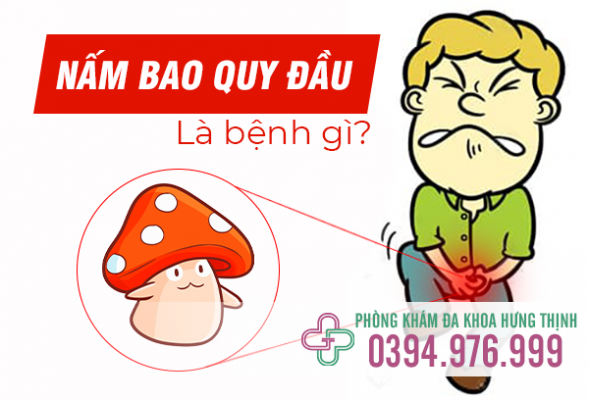 Viêm nấm bao quy đầu có sao không? Cách chữa trị