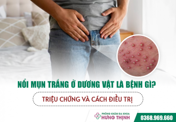 Nổi Mụn Trắng Ở Dương Vật Là Bệnh Gì? Triệu Chứng Và Cách Điều Trị