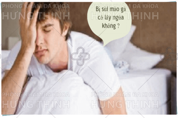 Sùi mào gà có gây ngứa không?