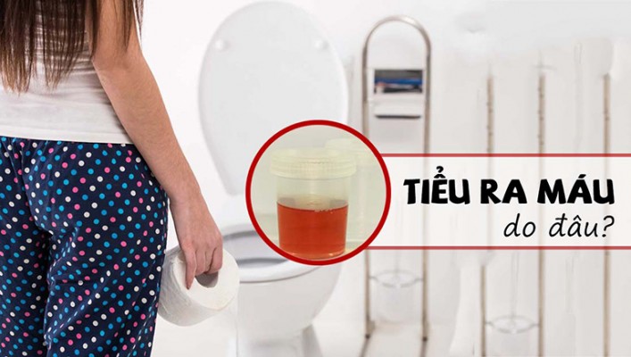 Tiểu ra máu và cách điều trị