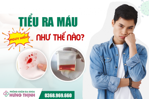 Tiểu ra máu nguy hiểm như thế nào? Chữa trị tại Phòng khám nam khoa uy tín