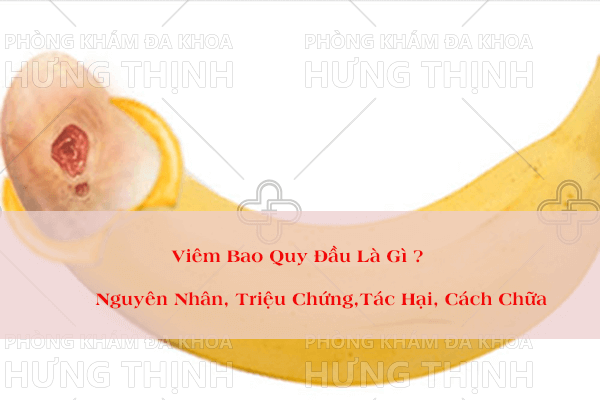 Viêm bao quy đầu là gì - nguyên nhân, triệu chứng, tác hại, cách chữa