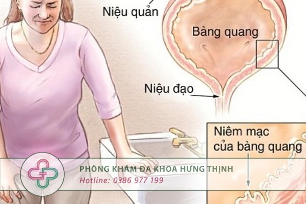 Chi phí chữa viêm niệu đạo tại Hà Nội bao nhiêu tiền