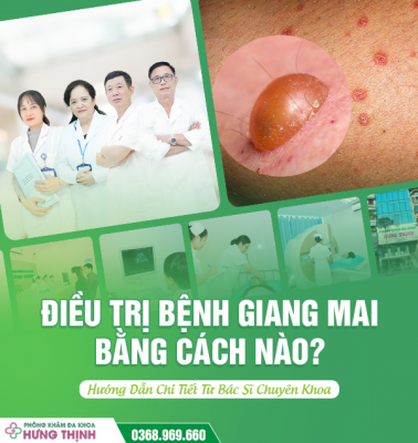 Điều Trị Bệnh Giang Mai Bằng Cách Nào? Hướng Dẫn Chi Tiết Từ Bác Sĩ Chuyên Khoa