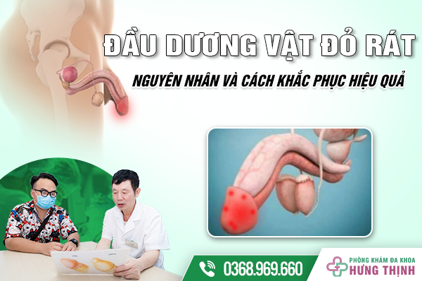 Đầu Dương Vật Bị Đỏ Rát Bệnh Gì? Nguyên Nhân Và Cách Khắc Phục Hiệu Quả